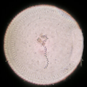 Vorticella 14.10.2022.jpg